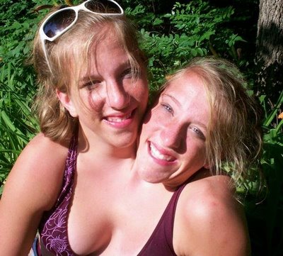 conjoined twins abby and brittany. Abigail and Brittany.